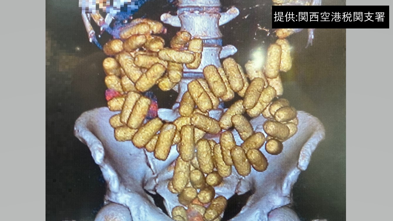 y摜zʂ̃RJC̓ɑ}ăuW֋֖ACTʐ^|fƘb  [799344304]->摜>6 